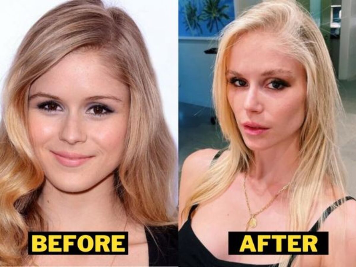 Erin-Moriarty-Before-After-Plastic-Surgery-Photo--1200x900.jpg
