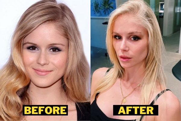 Erin-Moriarty-Before-After-Plastic-Surgery-Photo-.jpg