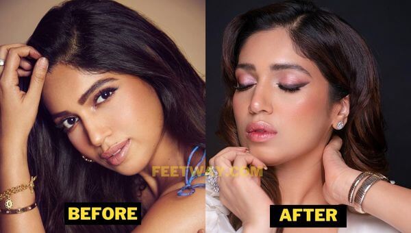 Bhumi Pednekar Plastic Surgery Details Before After Photos 5334