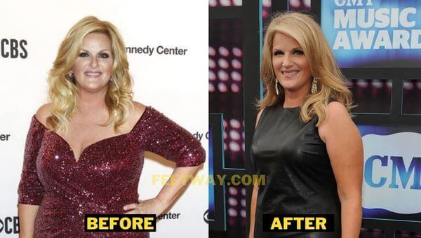 Trisha Yearwood Weight Loss Diet Workout Surgery Before After Pics   Trisha Yearwood Before After 