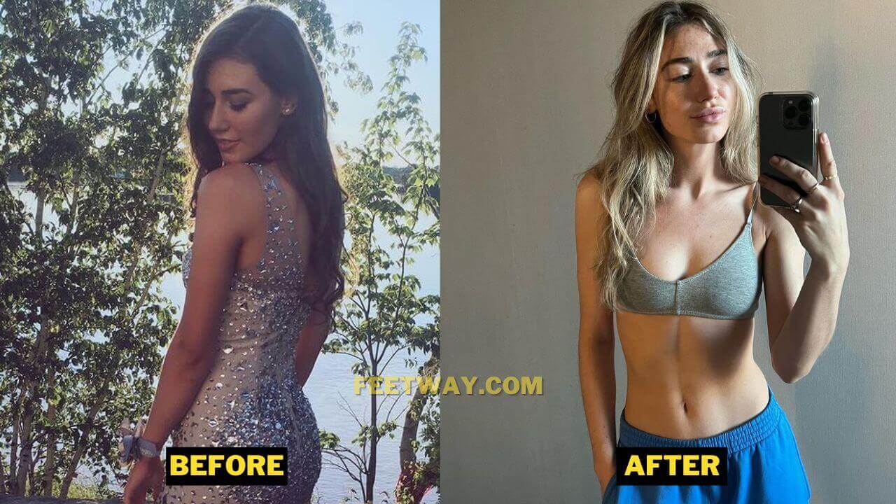 Kamilla Kowal Weight Loss Plastic Surgery And Lip Injection Details 3343